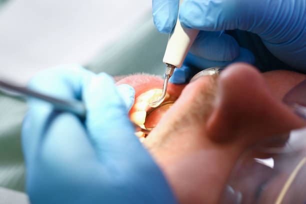  Wytheville, VA Emergency Dentist Pros