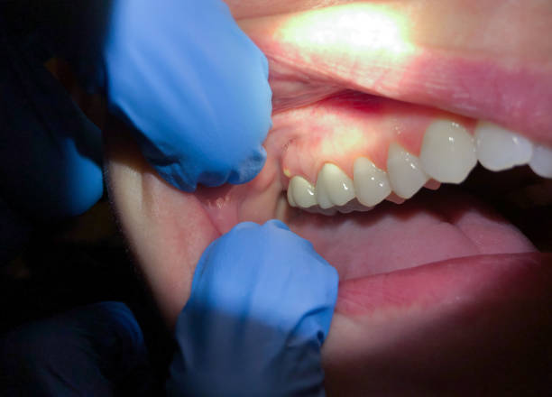 Best Walk-In Emergency Dentist in Wytheville, VA