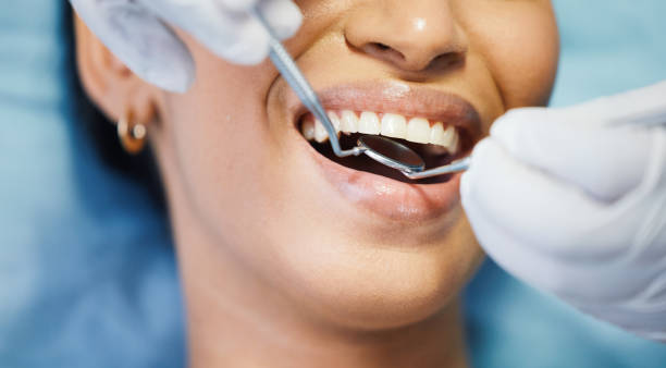 Best Emergency Root Canal Treatment in Wytheville, VA